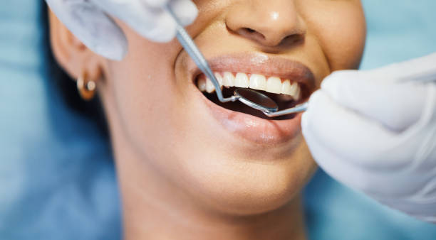 Best Knocked-Out Tooth Emergency  in Athens, IL